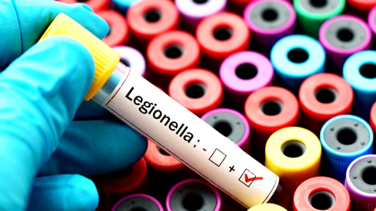 Zapobieganie zakażeniom bakteriami z rodzaju Legionella – zalecenia…
